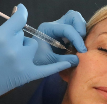 Dermal Fillers